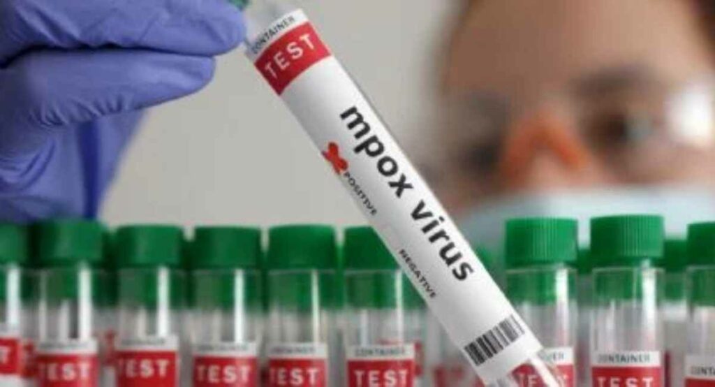 El mundo sabe “ya mucho” sobre el mpox, así que no se le puede considerar “el nuevo covid”, afirmó el director para Europa de la OMS, Hans Kluge.