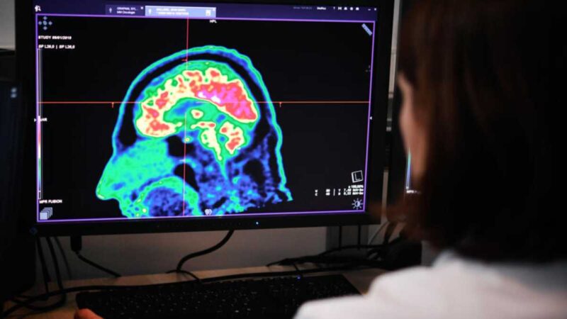 El equipo de investigadores, basado en California, había utilizado previamente una interfaz cerebro-ordenador (BCI, por sus siglas en inglés) para decodificar los pensamientos.