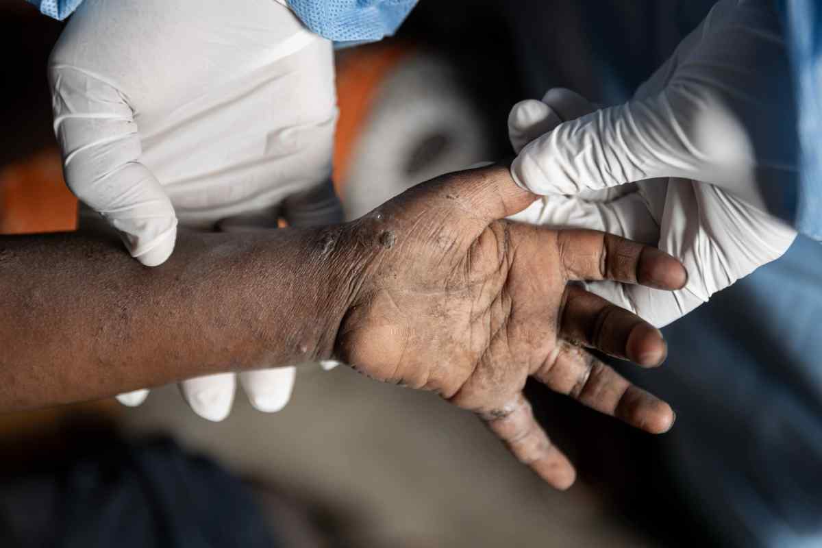 Informe de la OMS alerta sobre desafíos laborales en sistemas de salud en África